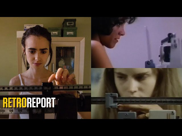 Myths and Misperceptions about Eating Disorders | Retro Report