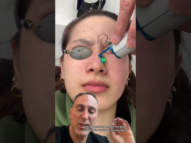 Treatment of Facial Redness