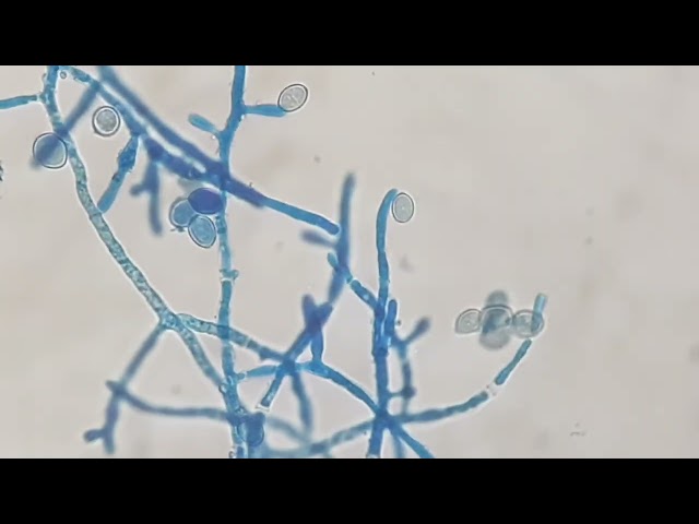 Spores , hyphae  and fungal growth demonstration