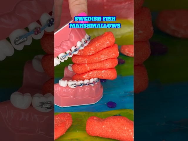 CANDY YOU CAN EAT WITH BRACES 👀 SHARK WEEK 🦈 ORTHODONTIST REACTS SATISFYING CANDY FOOD ASMR