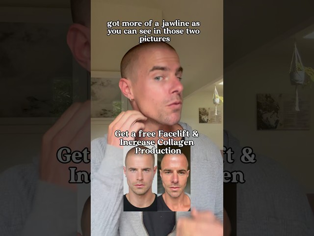 Free facelift and increase collagen production