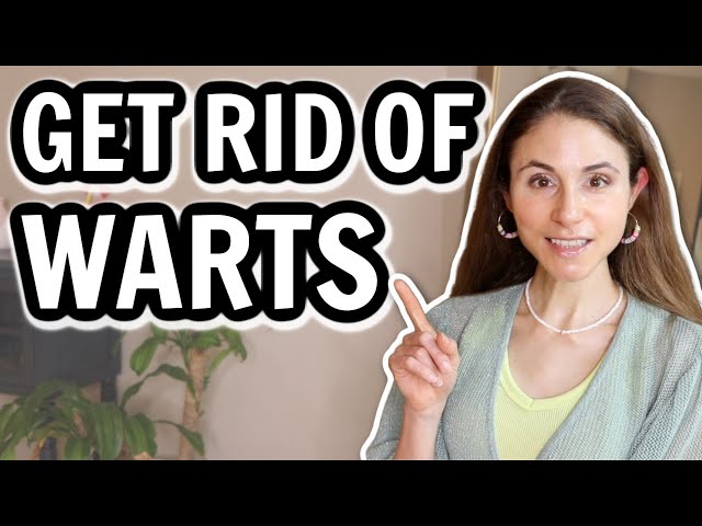HOW TO GET RID OF WARTS 👣🖐 DERMATOLOGIST @DrDrayzday