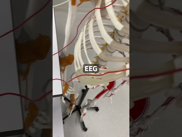 DIY Biomedical Instrumentation for A Robotic Arm: Surface EEG Monitoring System In the MAKING!
