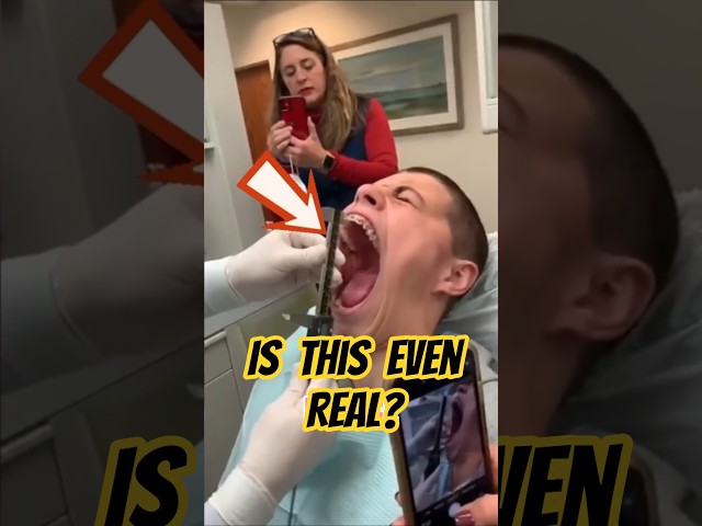 How Wide Can a Mouth Really Go?!