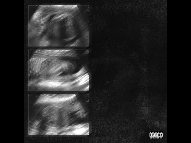 ULTRASOUND (DISS 21+)