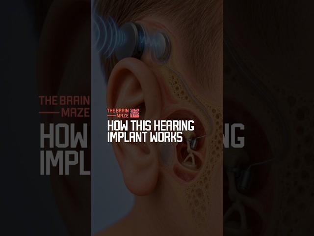 How This Hearing Implant Works
