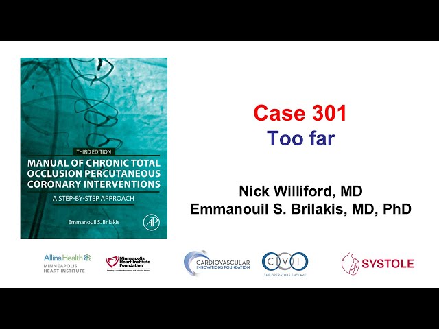 Case 301: Manual of CTO PCI -  Too far