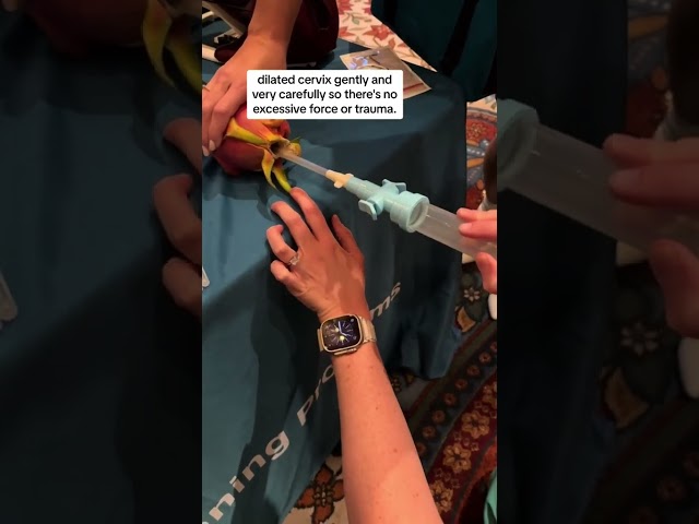 #OBGYN shows first trimester abortion simulation #shorts #medicalstudent