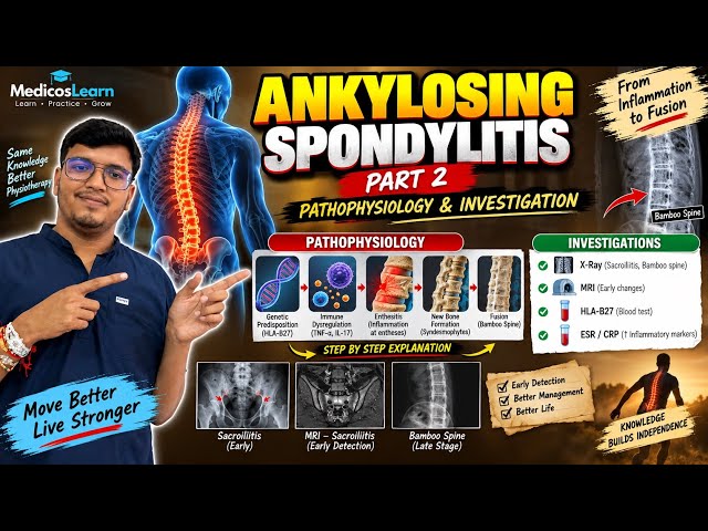 Ankylosing Spondylitis Part 2 | Pathophysiology & Investigations | HLA-B27, X-Ray & MRI