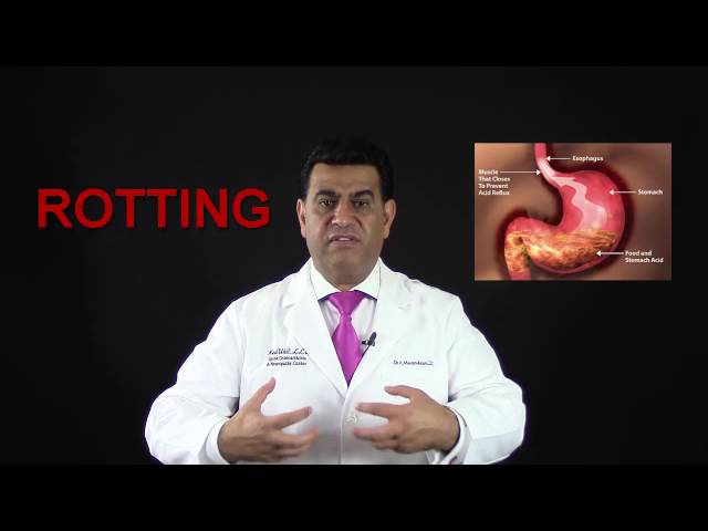 Stomach Doctor Heartburn Constipation Fix BErgen County Northern NJ
