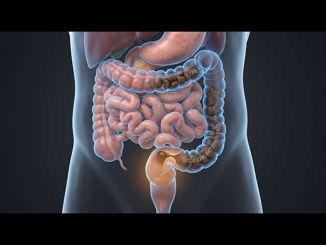 Constipation: How Stool Becomes Hard and Difficult to Pass