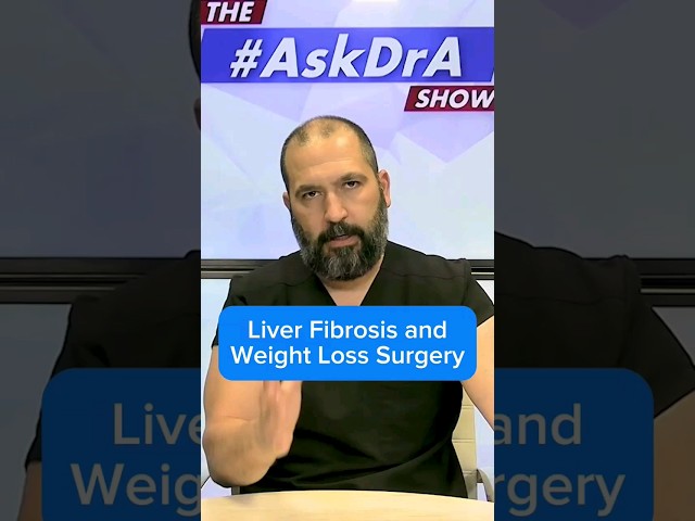 “If I have #Liver #Fibrosis, can I get #WeightLoss surgery?” #AskDrA #wls #wlscommunity #vsg
