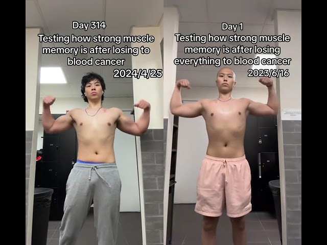 #duet with Kevin liu starting cut #leukemia #journey #gym... #Shorts #kevinliu_05