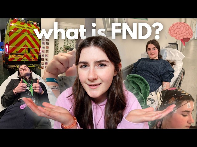 Functional Neurological Disorder | Symptoms, Treatments & My Experience  🧠