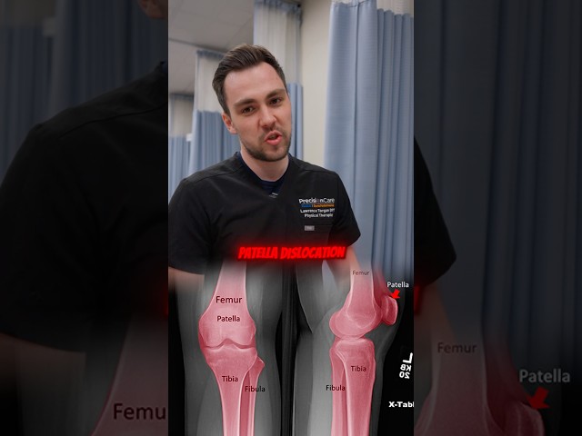 How to recover from a knee injury? #kneepain #injury #recovery