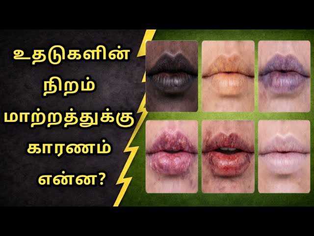 உதடு நிறம் மாற காரணம் | Health Signs !Lip Color Changes Meaning in Tamil ! இந்த உதடு நிறம் ஆபத்தா?