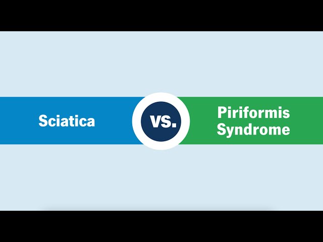 Sciatica vs. Piriformis Syndrome: What’s the Difference?