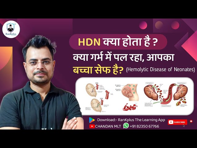 Hemolytic Disease Of The Newborn (HDN) | Erythroblastosis Fetalis | Hemolytic Disease of a Neonates