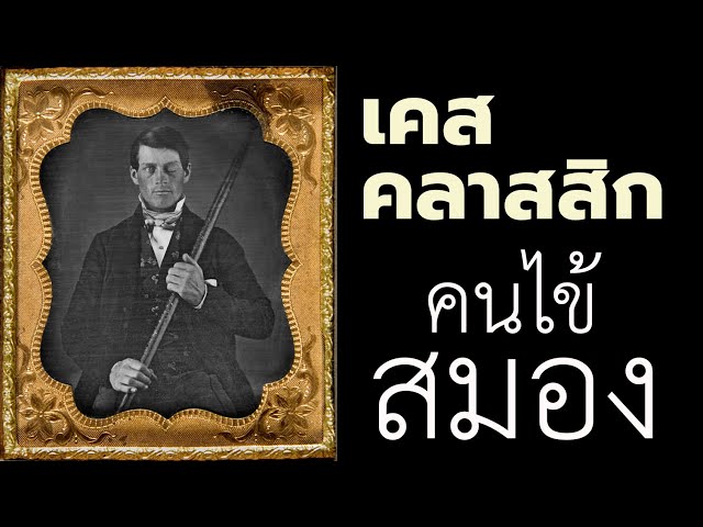 Brain Code Cast Ep.3 - เคสคลาสสิก คนไข้สมอง