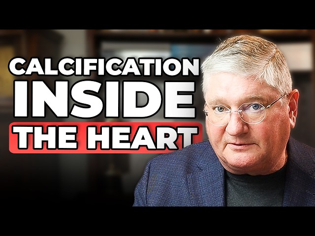 La verdadera razón por la que se calcifican las arterias: puntuación CAC