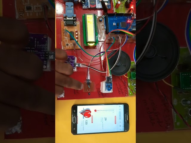 IOT BASED PARALYSIS PATIENT HEALTH MONITORING SYSTEM USING ARDUINO WITH GPRS MODEM #school #science