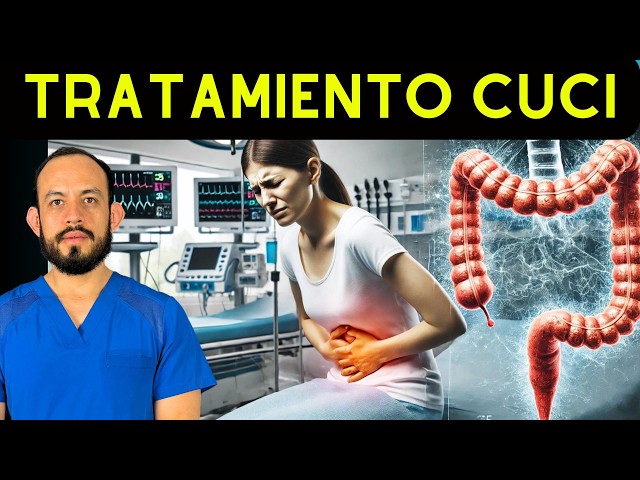 💊 Treatment of Ulcerative Colitis (UC): Medical Management and Surgery.