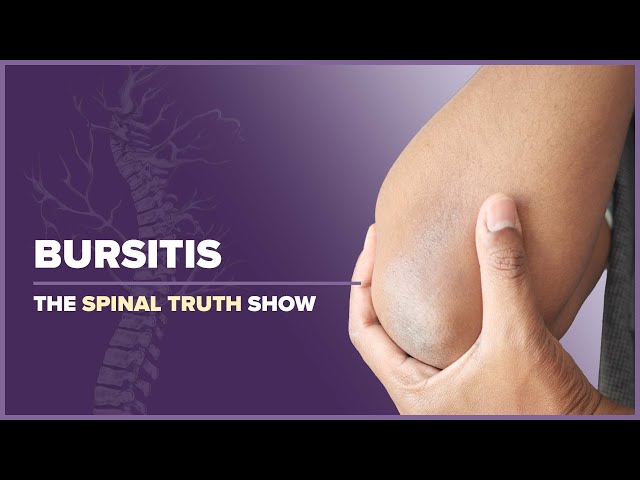 Bursitis: The Diagnosis Almost Everyone Gets Wrong