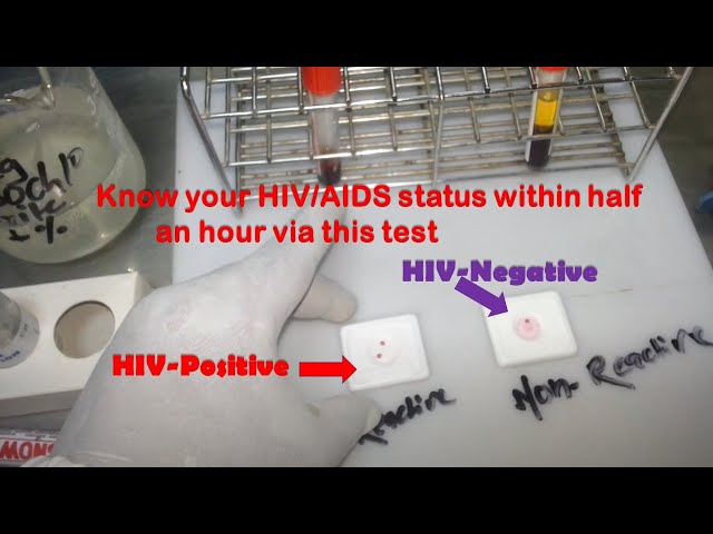 HIV Test Positive