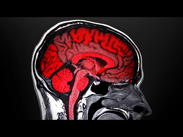 What Counter-Strike Does to Your Brain