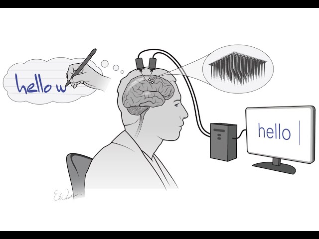 What is a Brain-Computer Interface (BCI)?