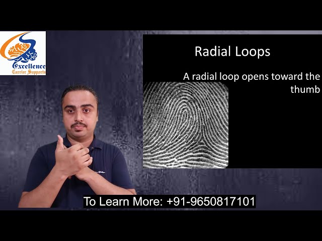 DMIT Radial Loop and characteristic