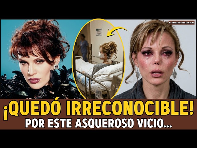 Carmen Campuzano: From "Top Model" to DISFIGURED... The DISGUSTING Powder That Rotted Her Nose.