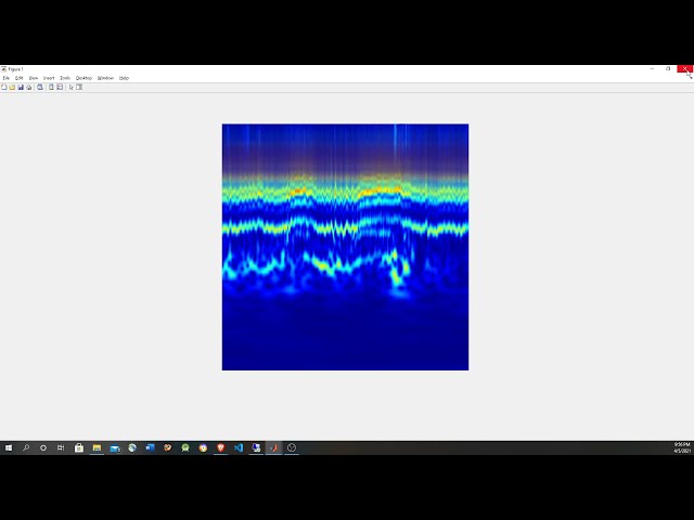Classifying ECG Signals in Simulink Using Convolutional Network (Deep Learning)