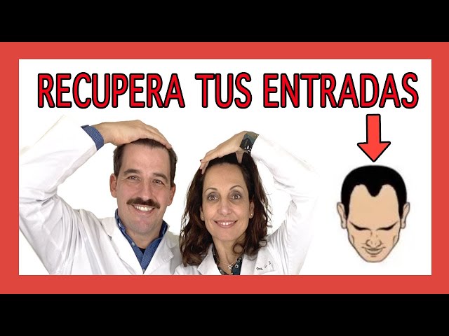 🟣DESCUBRE cómo RECUPERAR ENTRADAS sin injerto capilar  -- Evita el trasplante y la alopecia