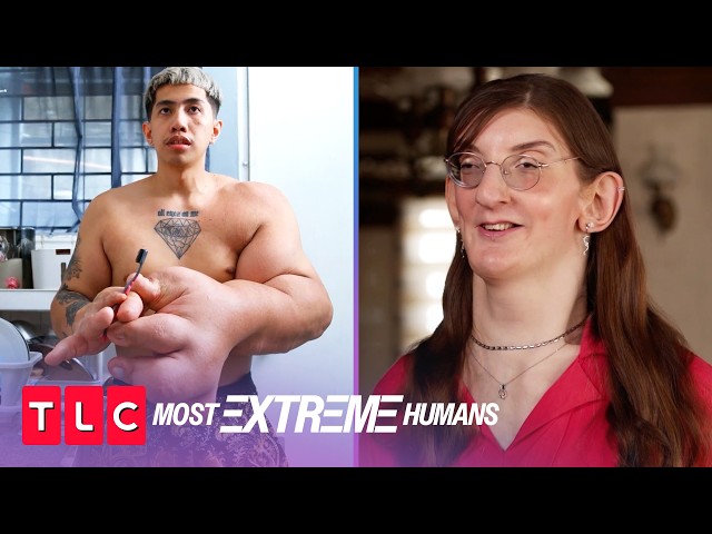 Mark and Rumeysa's Unique Conditions | Most Extreme Humans | TLC