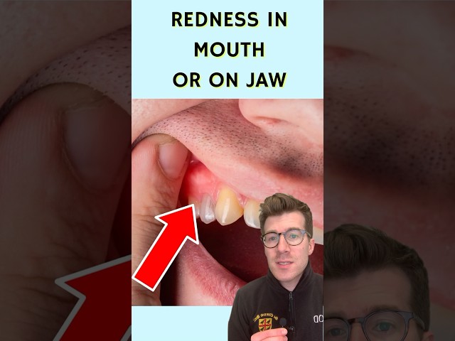 7 signs of a dental abscess … #shorts