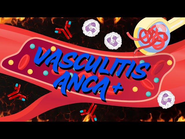 HIP VASCULITIS