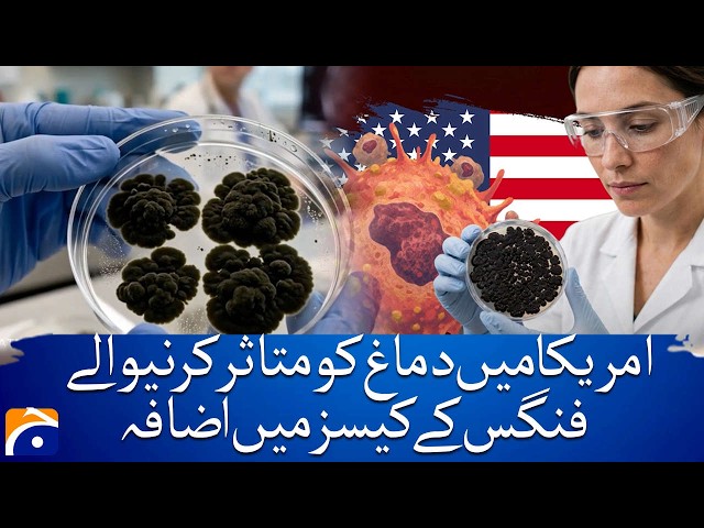 Growing Concern Over Brain Affecting Fungus Cases in the US | Geo News