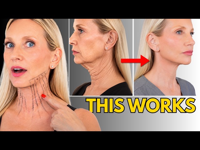4 Moves PROVEN to Tighten Jowls and Turkey Neck