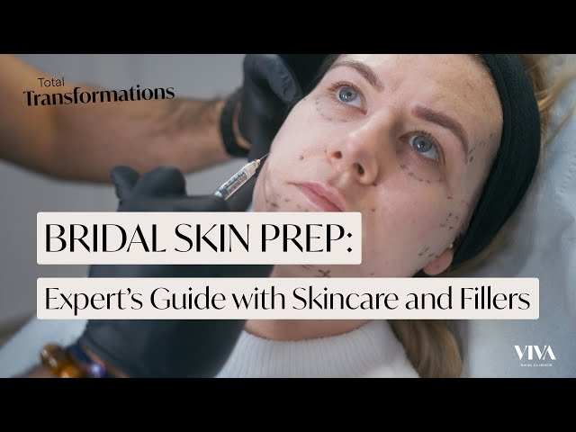Wedding Skin Prep 👰‍♀️: Expert's Guide with Skincare and Fillers | Total Transformations Ep 2