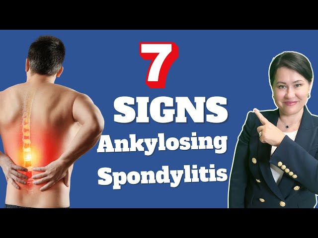 7 Signs of Ankylosing Spondylitis - A Rheumatologist Review
