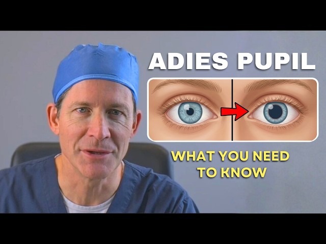 Adie’s Pupil Explained: Why One Pupil is Larger & Light Sensitivity