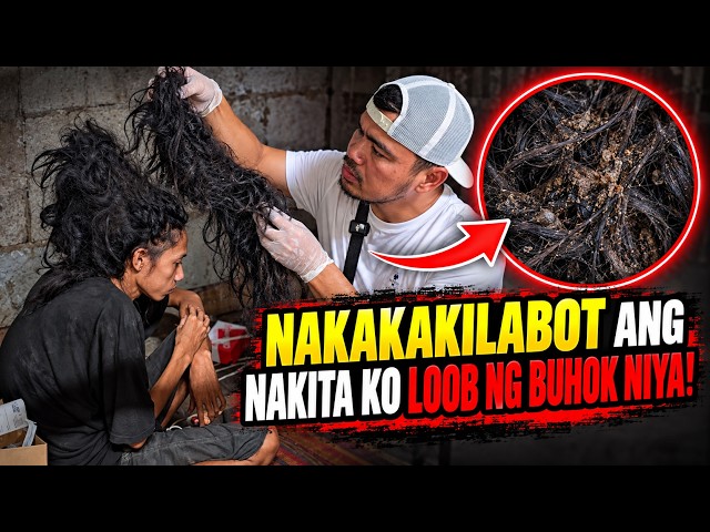 Part 4 Inuuod Na Yung Higaan Niya | Shocks Ano Tong Nasa Buhok Niya?