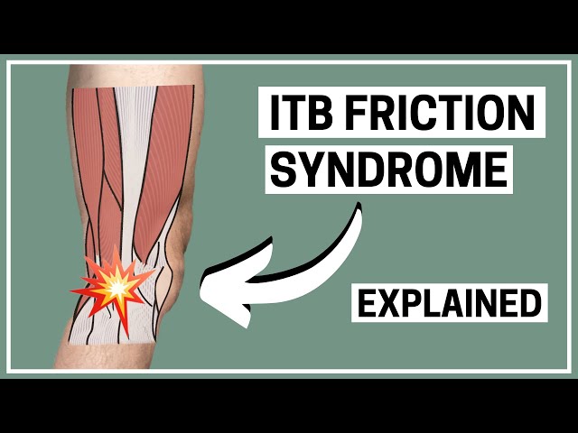 Rodilla del corredor: explicación del diagnóstico y tratamiento del síndrome de fricción de la ba...