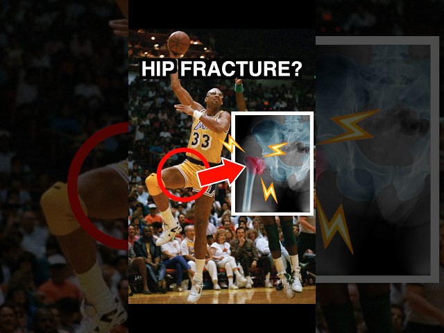 Doctor Explains: Kareem Abdul-Jabbar HIP FRACTURE 🦴💢