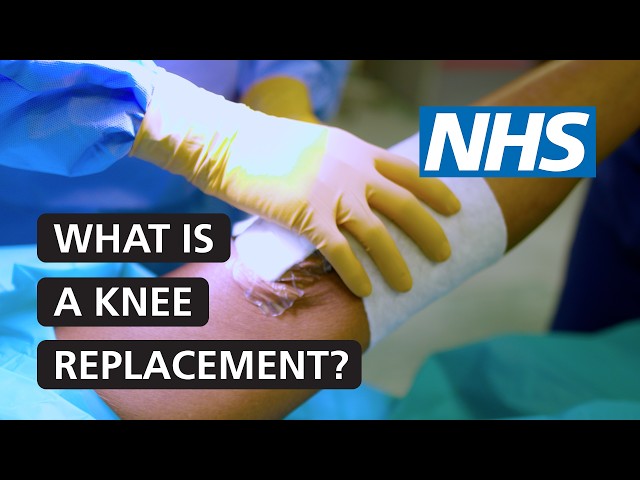 Knee replacement surgery | NHS