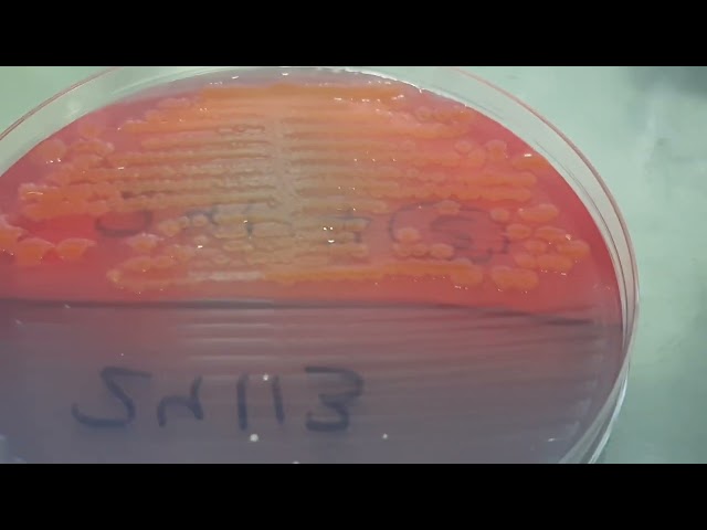Colony characteristics of Citrobacter freundii on CLED Agar of Urine Culture