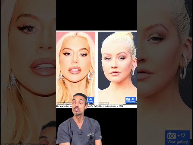 Christina Aguilera’s Jaw-Dropping Transformation Explained! 😍 | Dr Julian De Silva