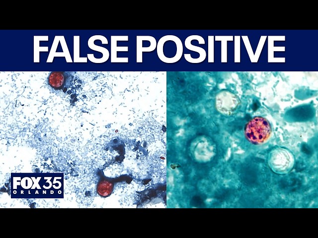 Taylor Farms cyclospora test false: What's the cause?