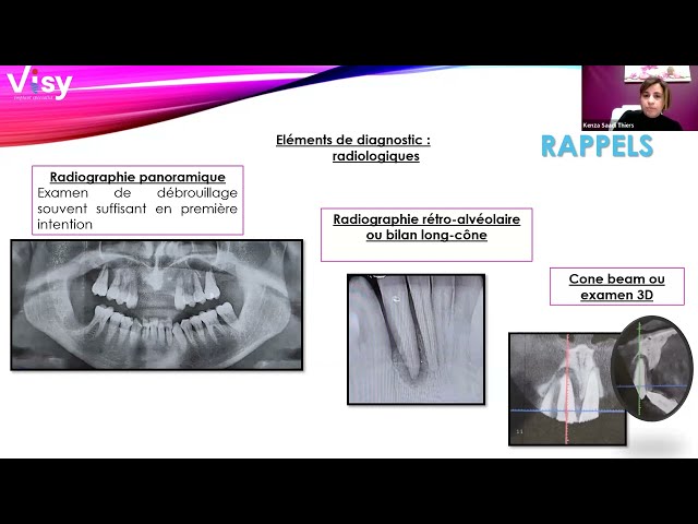 Prise en charge parodontale : de la consultation à la maintenance
